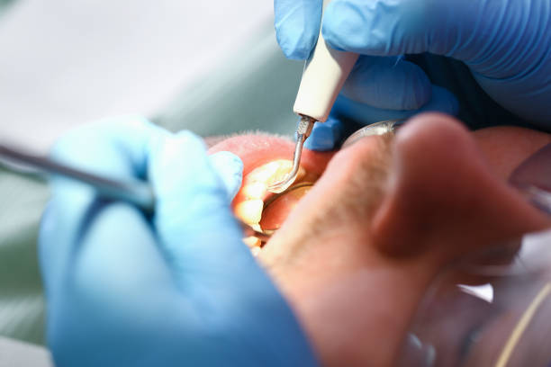 Best Mobile Emergency Dentist in Vauxhall, NJ